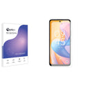 Blue Light Blocking Screen Protector for TCL 60R 5G.