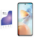 Blue Light Blocking Screen Protector for Nubia Music 2.